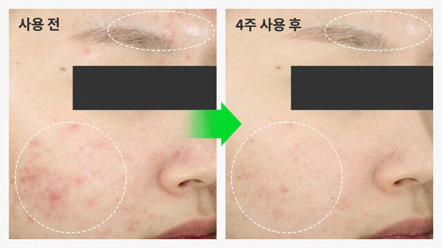 Troubless Mild Clear Toner Essence 200ml — product image 3