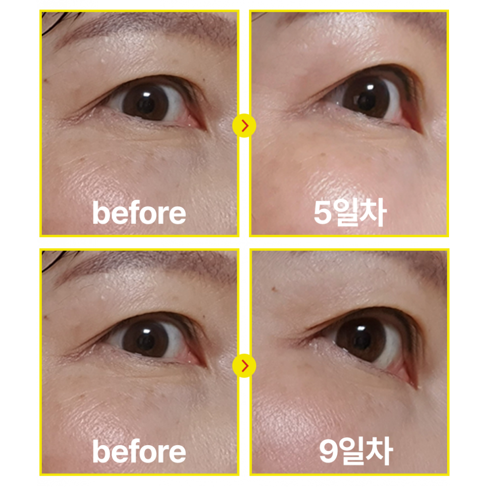Be The Skin Vegan Retinal Bakuchiol Serum 20ml — product image 3