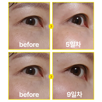 Be The Skin Vegan Retinal Bakuchiol Serum 20ml — product image 3