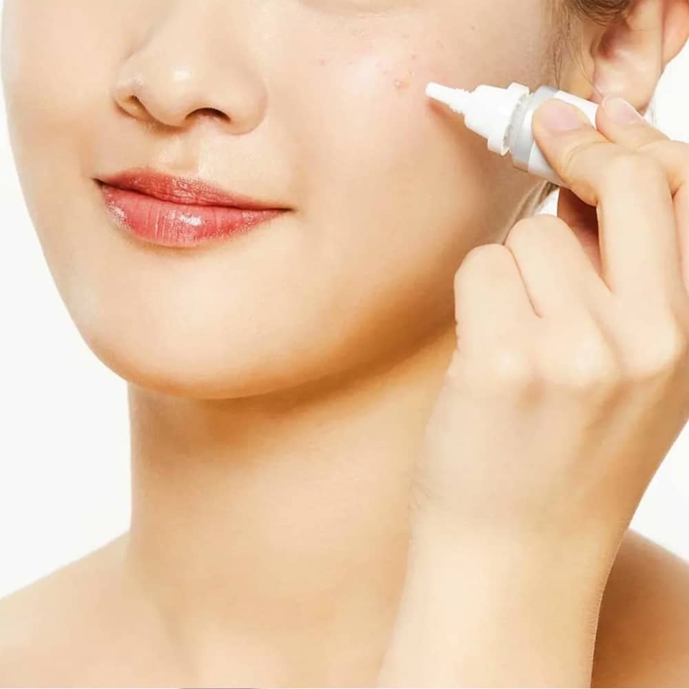 COSRX AC Collection Ultimate Spot Cream 30g — product image 2