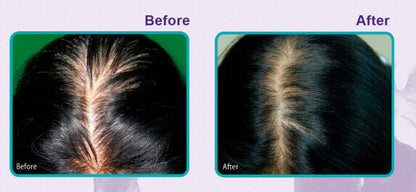 Daeng Gi Meo Ri Vitalizing Scalp Nutrition Pack for Hair-loss 145ml — product image 4