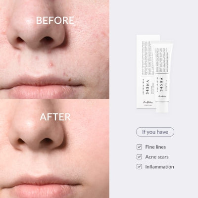 Dr. Althea 345 Relief Cream — product image 5