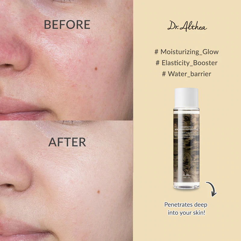 Dr. Althea Anastatica Skin Conditioning Toner — product image 2