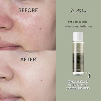 Dr. Althea Anastatica Skin Conditioning Toner — product image 4