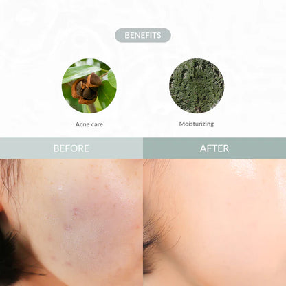 Dr. Althea Last Minute Skin Rescue Anastatica Mask 30pcs 310g — product image 5