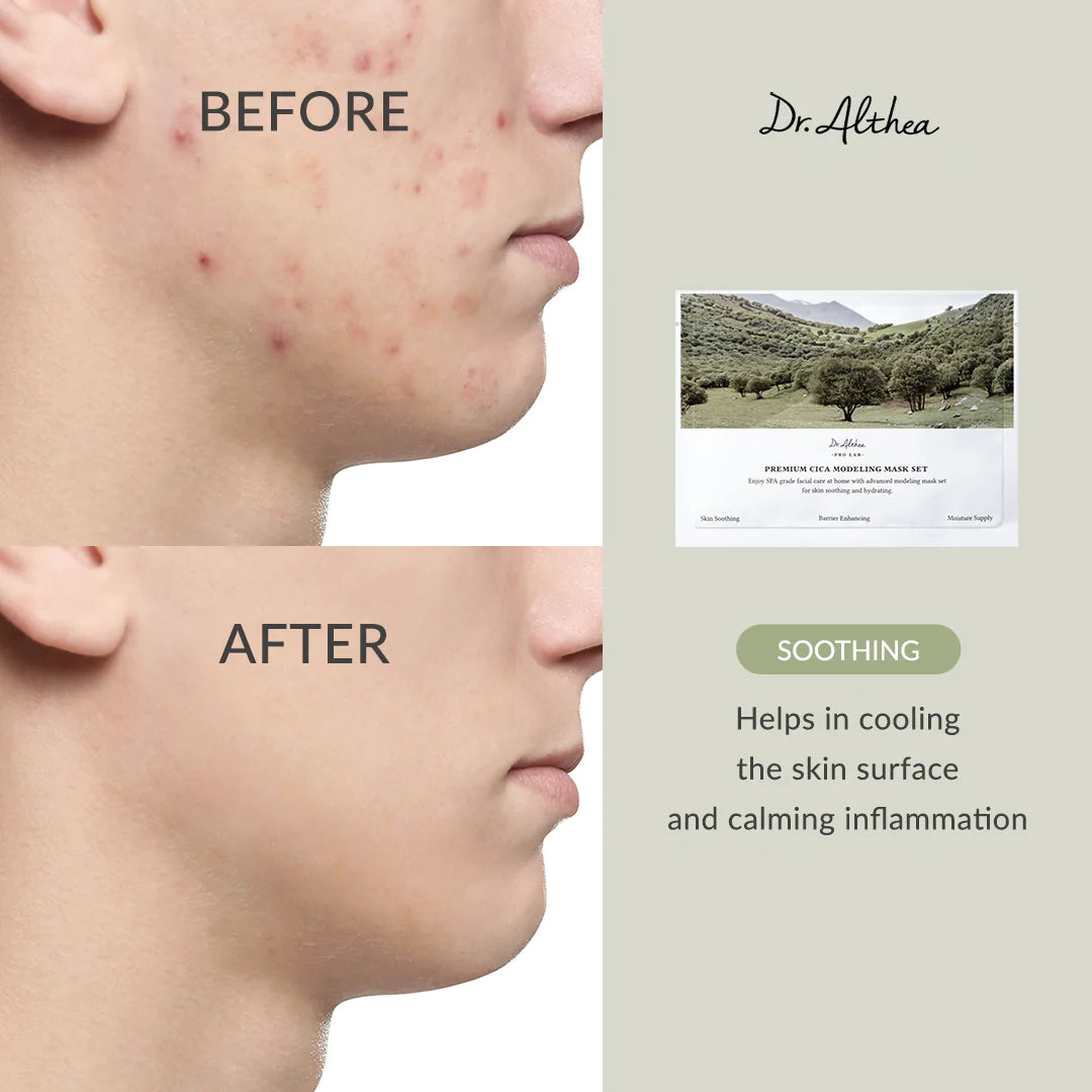 Dr. Althea Premium Cica Modeling Mask Set — 5 Packs