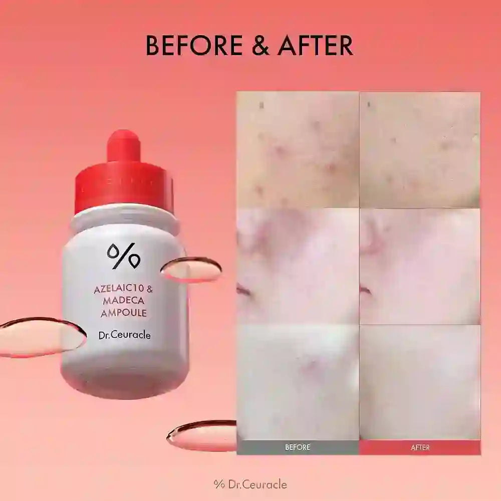 Dr. Ceuracle Azelaic10 & Madeca Ampoule 30ml — product image 2