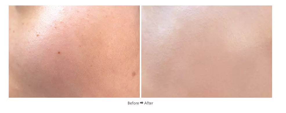 Dr. Hedison Miracle Cushion SPF50+ PA+++ Natural Beige 15g+15g — product image 2