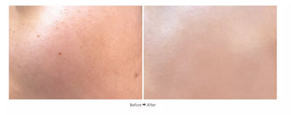 Dr. Hedison Miracle Cushion SPF50+ PA+++ Natural Beige 15g+15g — product image 2