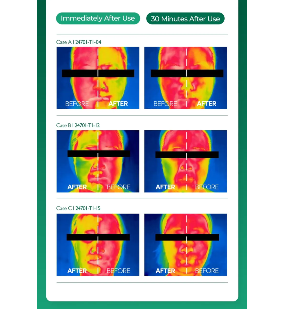 Dr. Melaxin Cicapyrin Calming Ampoule 30ml — product image 2