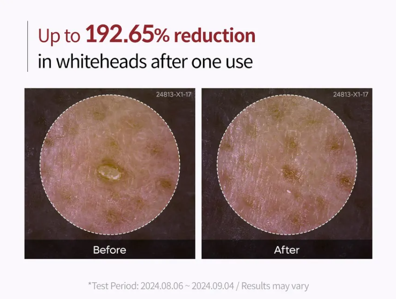 Dr. Melaxin Peel Shot Exfoliant White Rice Ampoule 80ml — product image 7