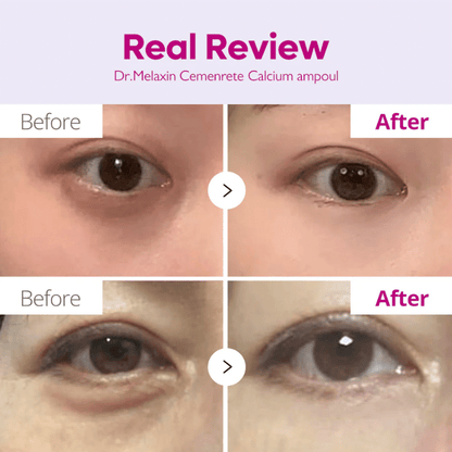 Dr. Melaxin Cemenrete Calcium Volume Ampoule Plus 30ml — Фото товара 2