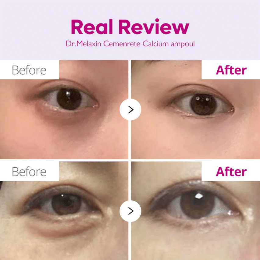 Dr. Melaxin Cemenrete Calcium Volume Ampoule Plus 30ml — Фото товара 2