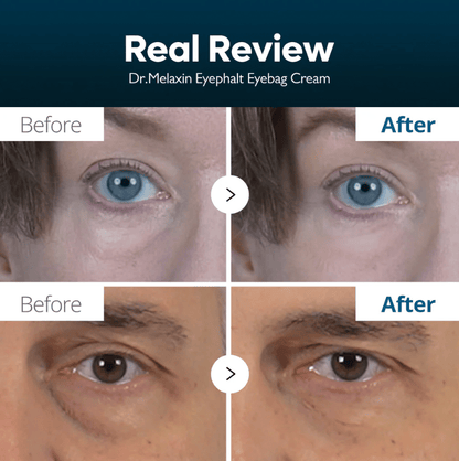 Dr. Melaxin Eyephalt Eyebag Cream 10ml — product image 3
