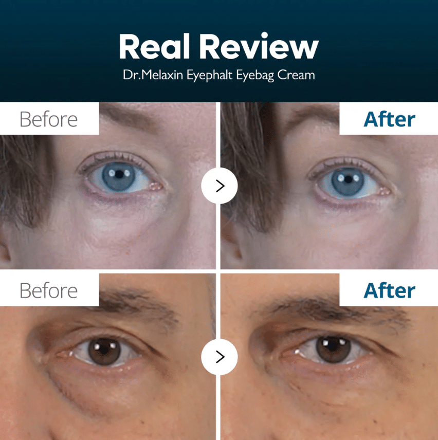 Dr. Melaxin Eyephalt Eyebag Cream 10ml — product image 3