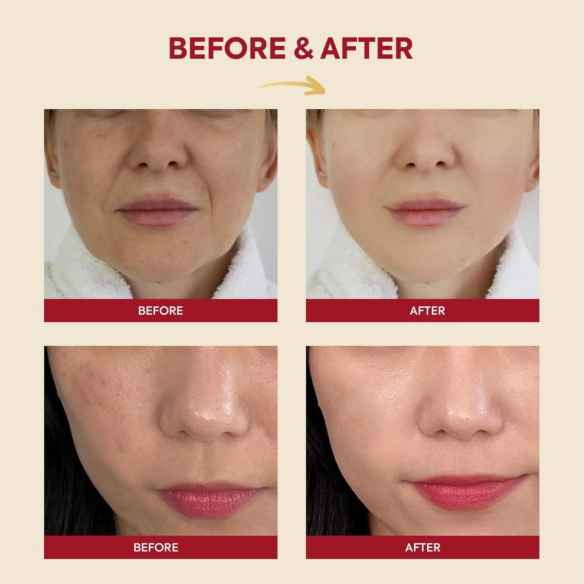KSECRET Seoul 1988 Essence Snail Mucin 97% + Rice 100ml — product image 3