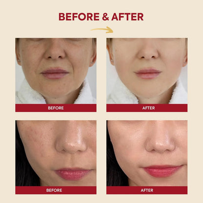 KSECRET Seoul 1988 Essence Snail Mucin 97% + Rice 100ml — product image 3