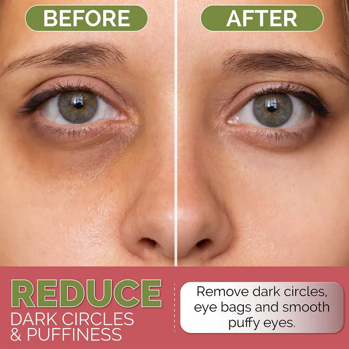 lookATME Hydrogel Eye Patch Hyaluronic Acid and Coffeine 60ea — product image 4