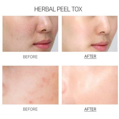 Medi Peel Herbal Peel Tox Wash Off Type Cream Mask PRO — Imagen del producto 5