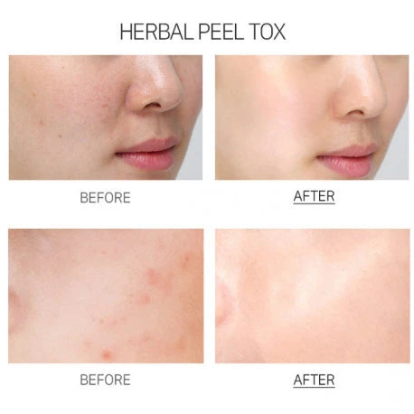 Medi Peel Herbal Peel Tox Wash Off Type Cream Mask PRO — Imagen del producto 5