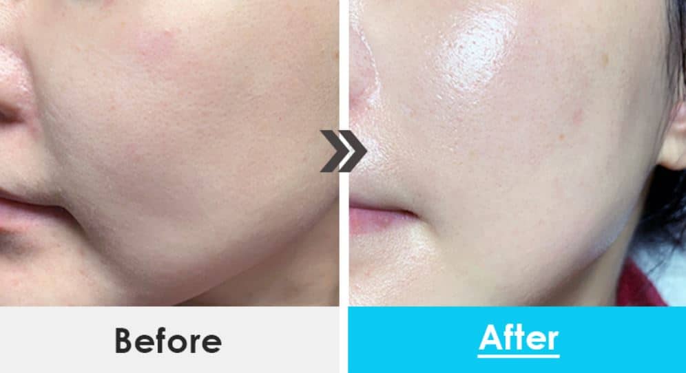 Medi Peel Power Aqua Cream 50ml — product image 2