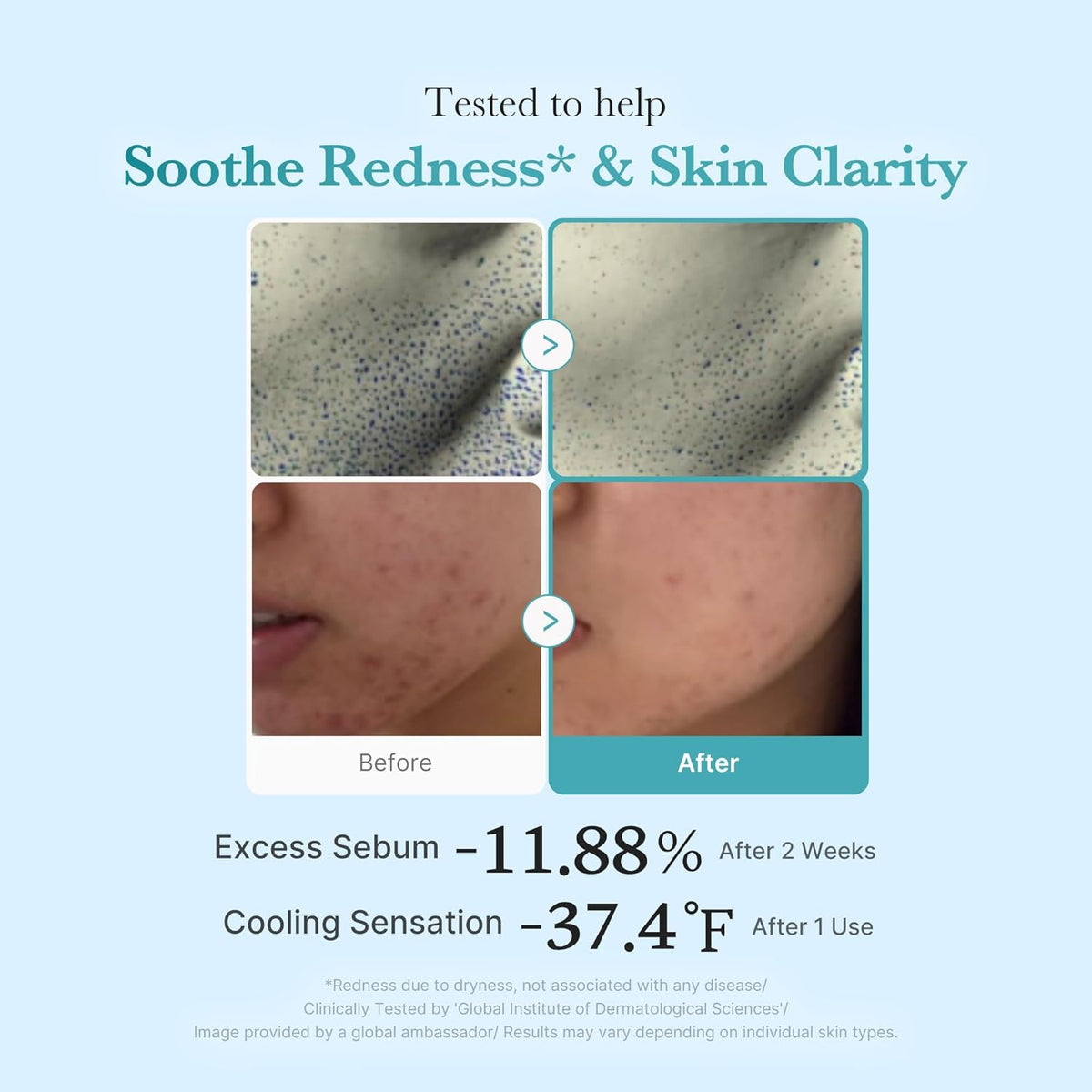 Medicube Azelaic Acid Niacinamide Clear Toner 250ml — product image 4