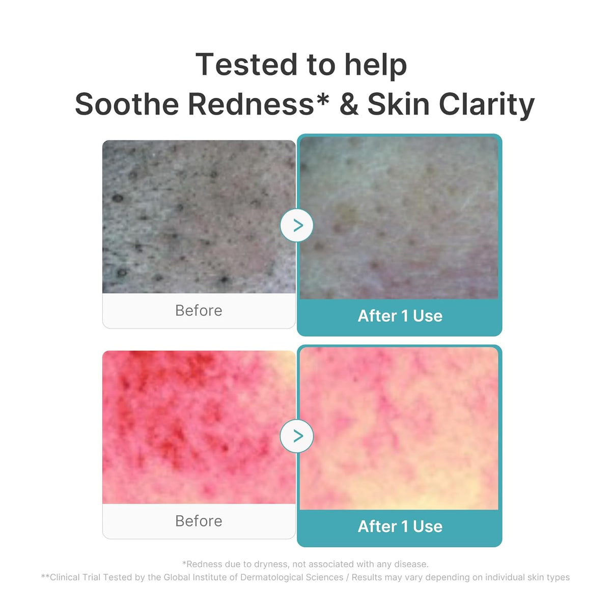 Medicube Azelaic Acid Niacinamide Deep Clean Foam Cleanser 120g — product image 4