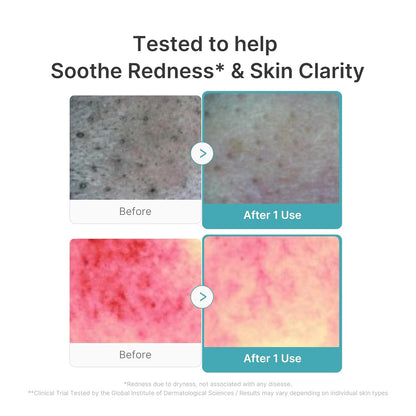 Medicube Azelaic Acid Niacinamide Deep Clean Foam Cleanser 120g — product image 4