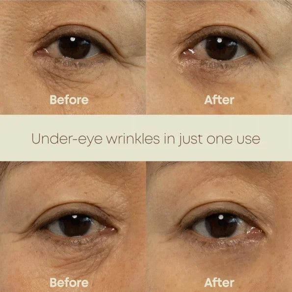 NINE LESS Ever Youth Dual Effect Eye Cream 20ml — product image 2
