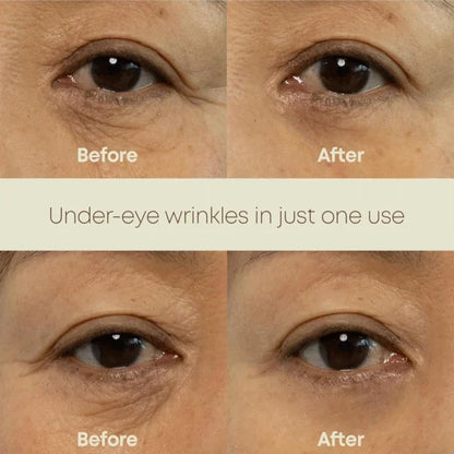 NINE LESS Ever Youth Dual Effect Eye Cream 20ml — product image 2