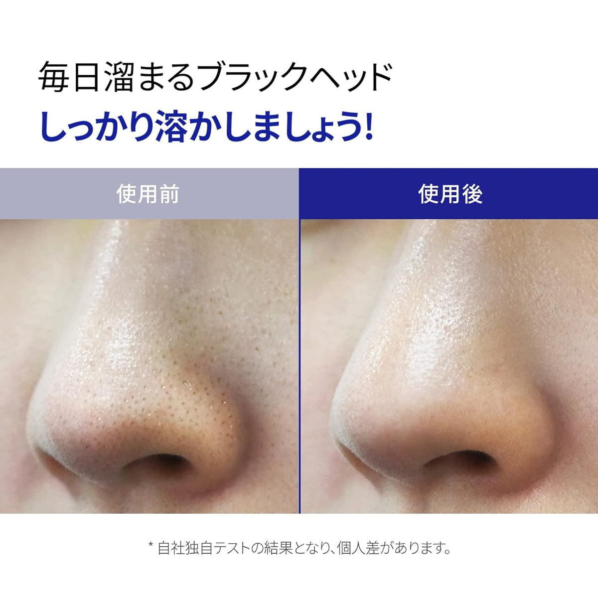 One Days You P.Z Ssg Ssag Deep Cleansing Foam 150ml — product image 2