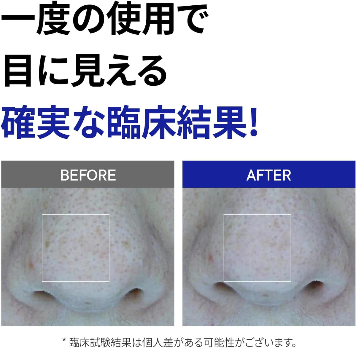 One Days You No More Blackhead Pore Gel Cream 25ml — product image 2