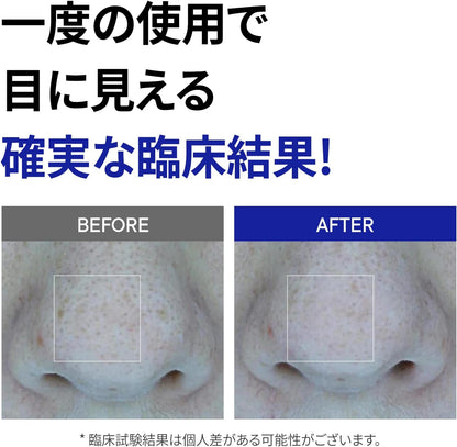 One Days You No More Blackhead Pore Gel Cream 25ml — product image 2