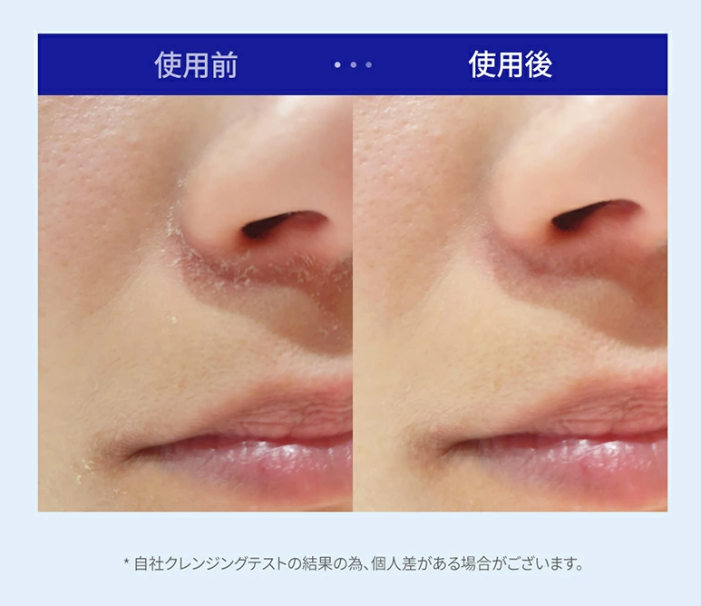 One Days You Help Me Bubble Cleansing Pads 60pads — product image 2