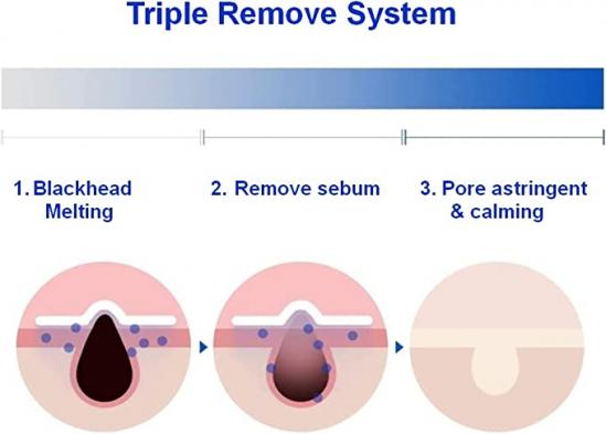 One days you P.Z Ssoc Ssoc No More Blackhead 100ml — product view 4