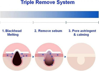 One days you P.Z Ssoc Ssoc No More Blackhead 100ml — product view 4