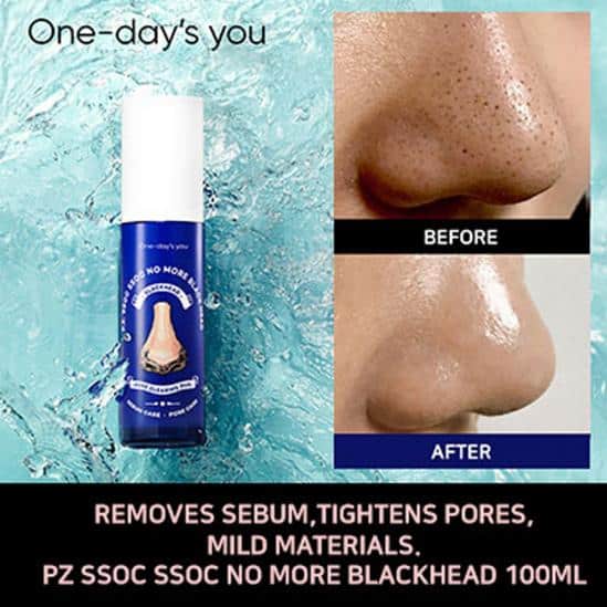One days you P.Z Ssoc Ssoc No More Blackhead 100ml — product view 5