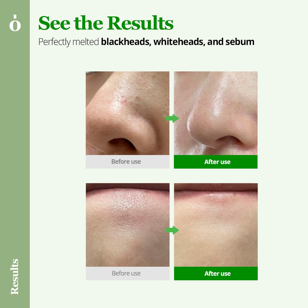 Ongredients Perfect Melting Cleansing Balm 100ml — product image 2
