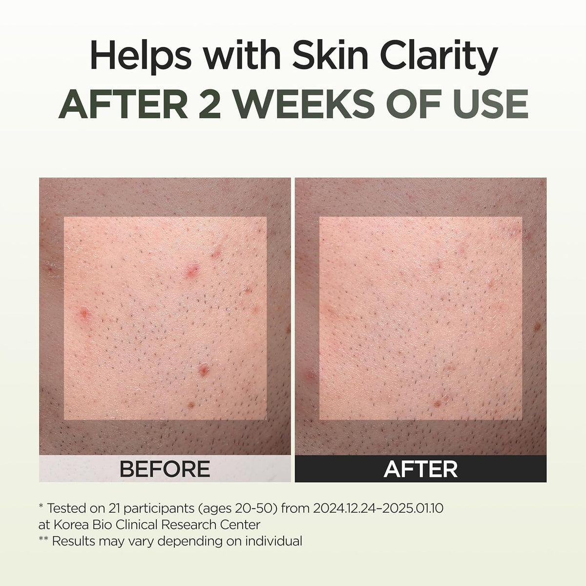 P.CALM 9 Seaweed Spot Correcting Serum 30ml — product image 3