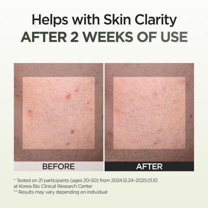 P.CALM 9 Seaweed Spot Correcting Serum 30ml — product image 3