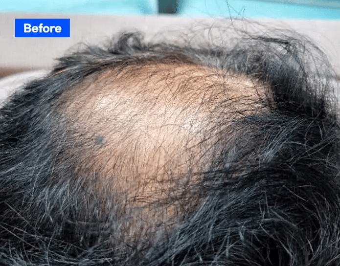 ROOTONIX Dr. Root Volume Booster — product image 3