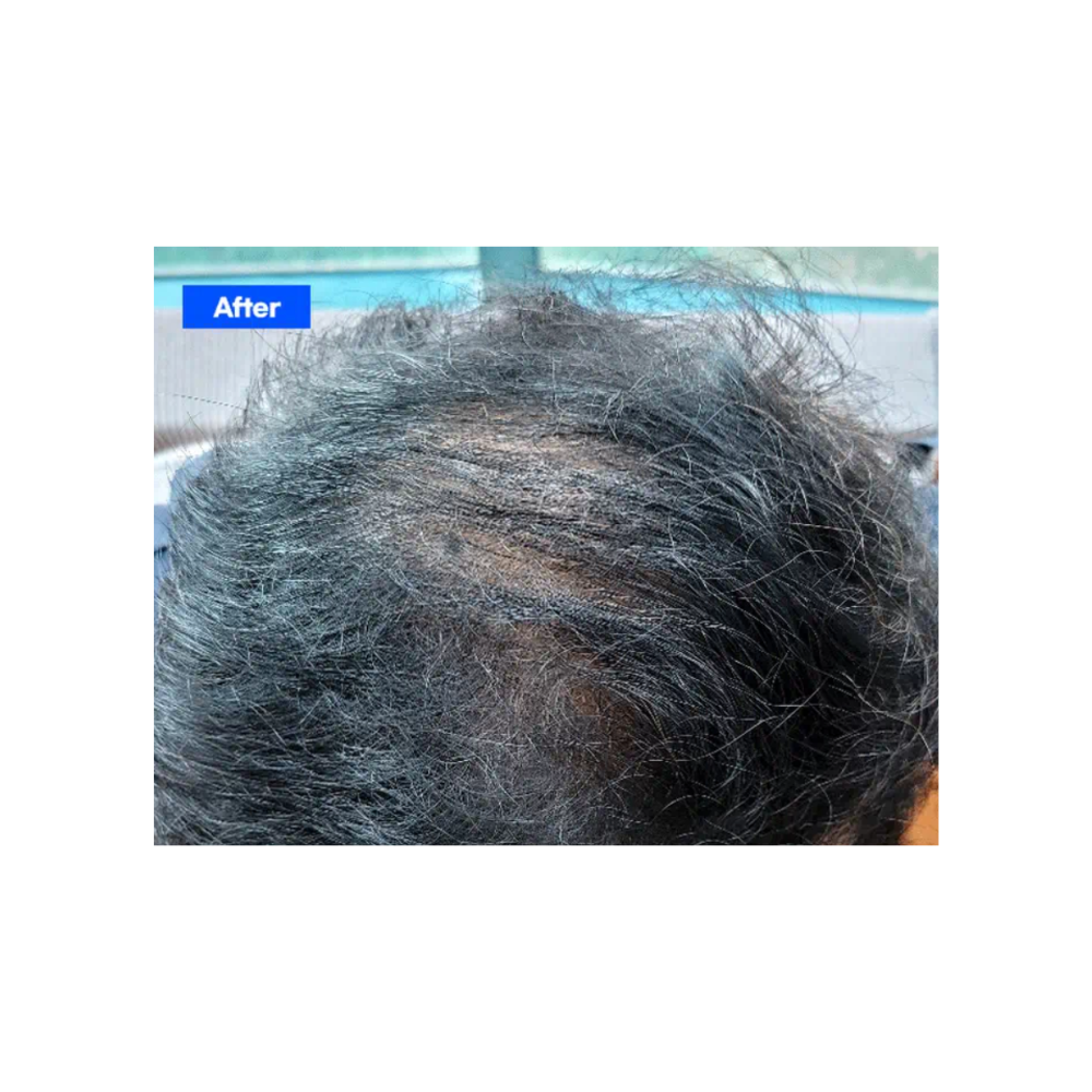 ROOTONIX Dr. Root Volume Booster — product image 4
