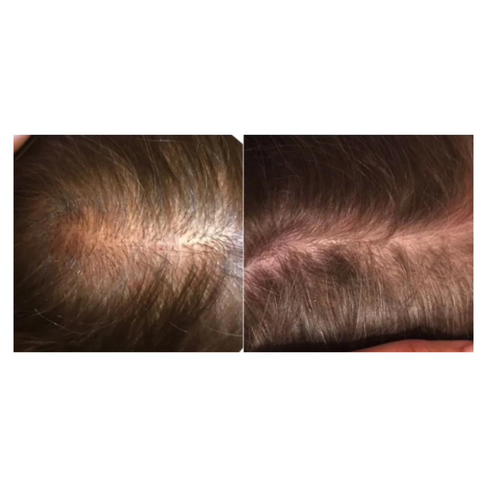 ROOTONIX Roobliss Scalp Salt Scaler 200g — product image 2