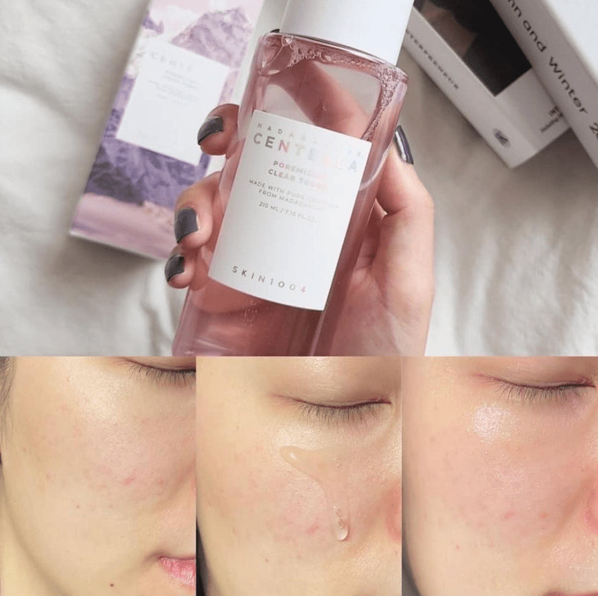 Skin1004 Madagascar Centella Poremizing Clear Toner — Фото товара 3