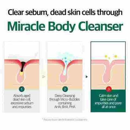 Some By Mi Acne Clear Body Cleanser 400ml — product image 2