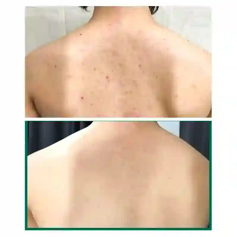 Some By Mi Acne Clear Body Cleanser 400ml — product image 3