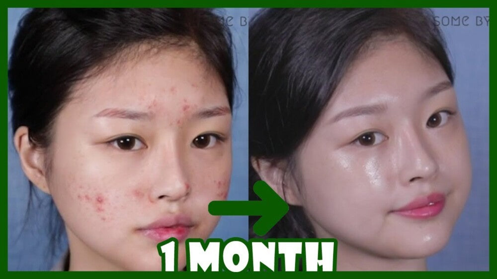 Some By Mi AHA-BHA-PHA 30 Days Miracle Cream 60g — product image 2