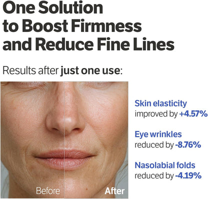 Sungboon Editor Deep Collagen Retinol Power Boosting Pad 100pcs — product image 5