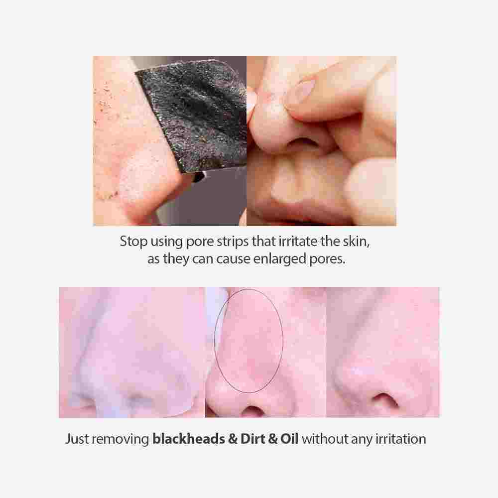 Sungboon Editor Blackhead Melting Clear Pad 30pcs — product image 2