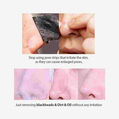 Sungboon Editor Blackhead Melting Clear Pad 30pcs — product image 2